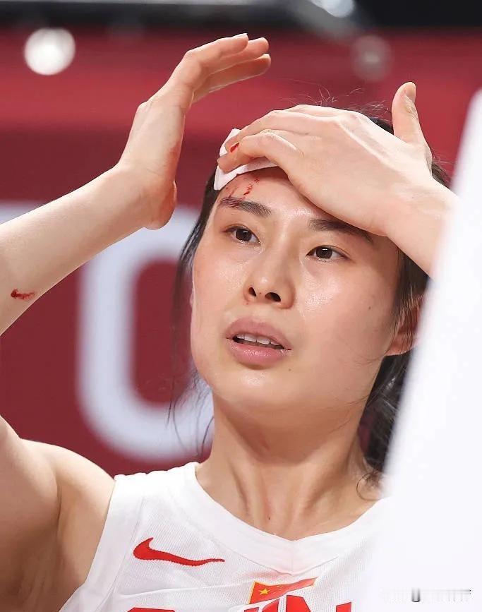 一个打不了！一个90度崴脚！中国女篮还未出征，就已经陷入绝境！
女篮世界杯还有一