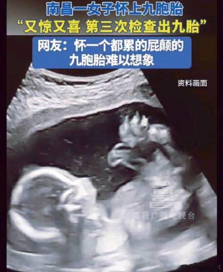 江西9胞胎女子开始考虑追责  怀上九胞胎女子发声  原来是又惊又喜，现在又考虑追