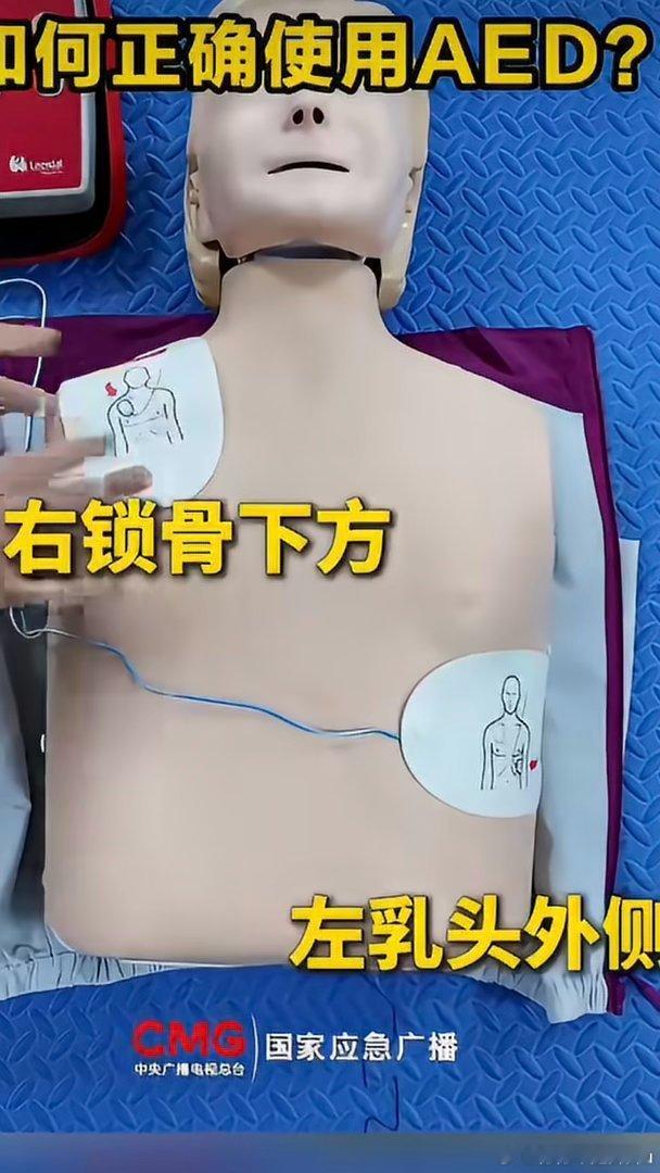 11城加装AED11座城市新增AED设备，救命神器走进公共场所。但很多网传急救方