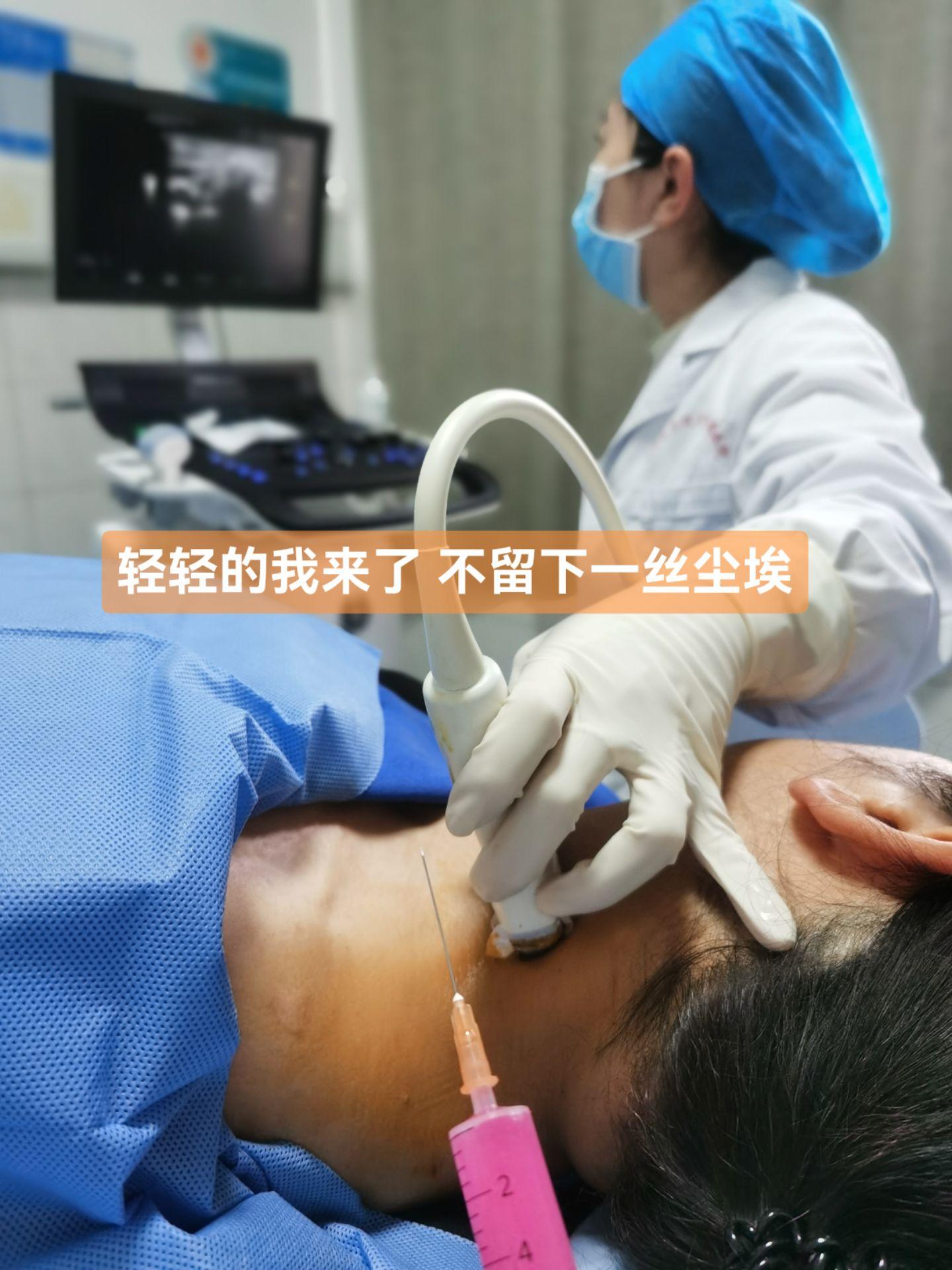 神经根型颈椎病