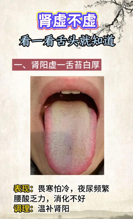 肾气足不足，看一看舌头就知道