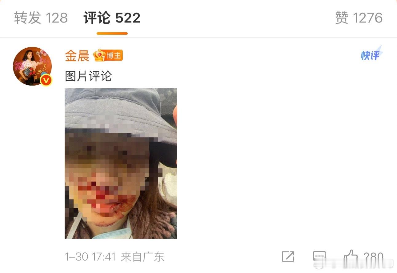 金晨道歉回应也来了，和通报一致：出去玩的时候为了躲突然窜出来的小狗，紧急拐弯出了