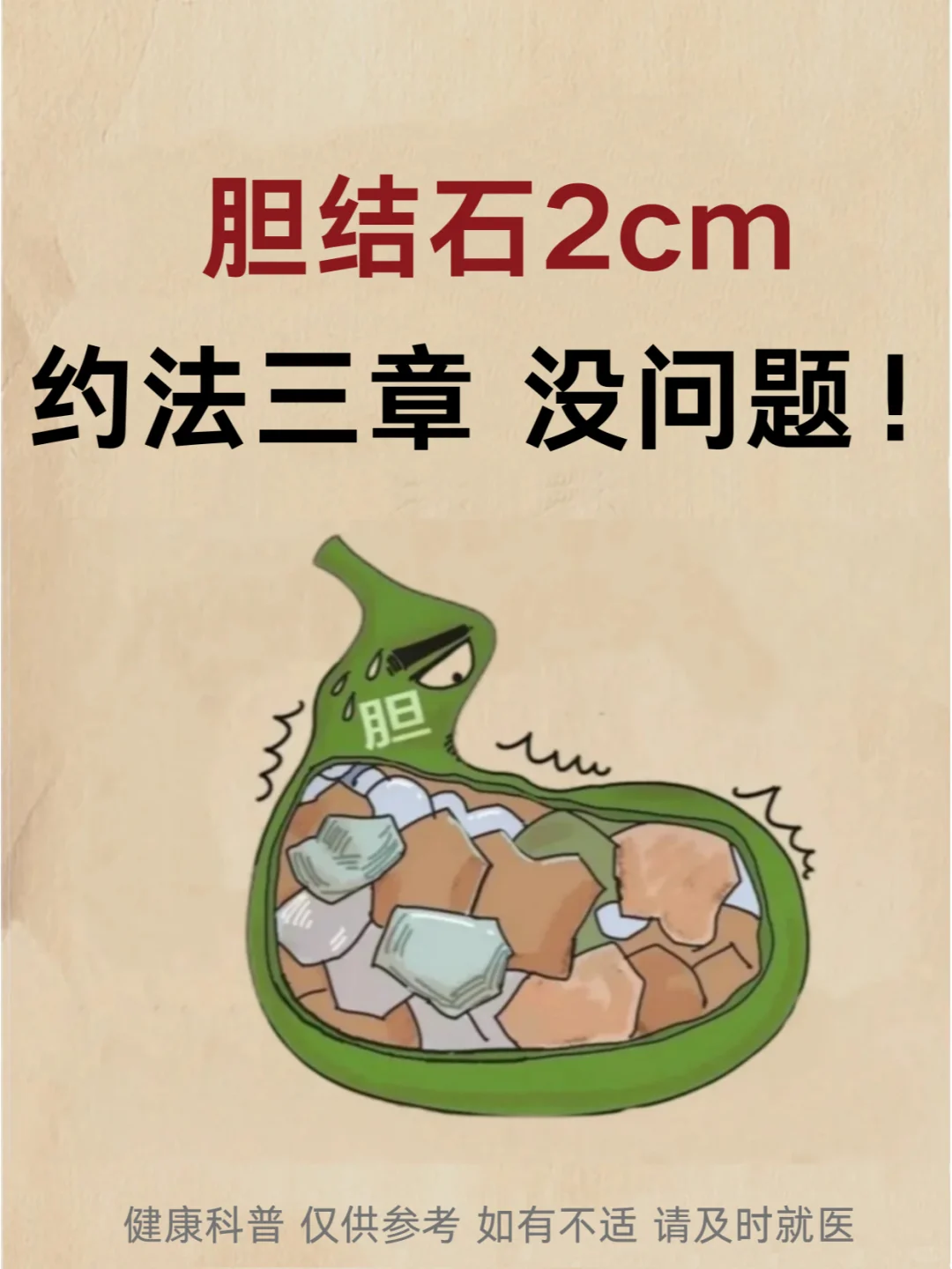 胆结石2cm，约法三章，没问题！