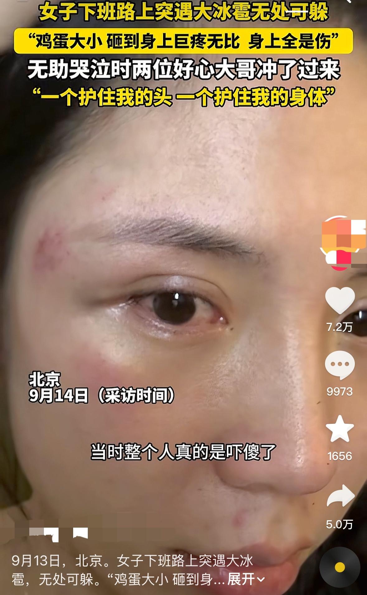 天上下的冰雹像鸡蛋一样大
女子全身被砸伤

9月13日晚，一位女子下班后正走在路