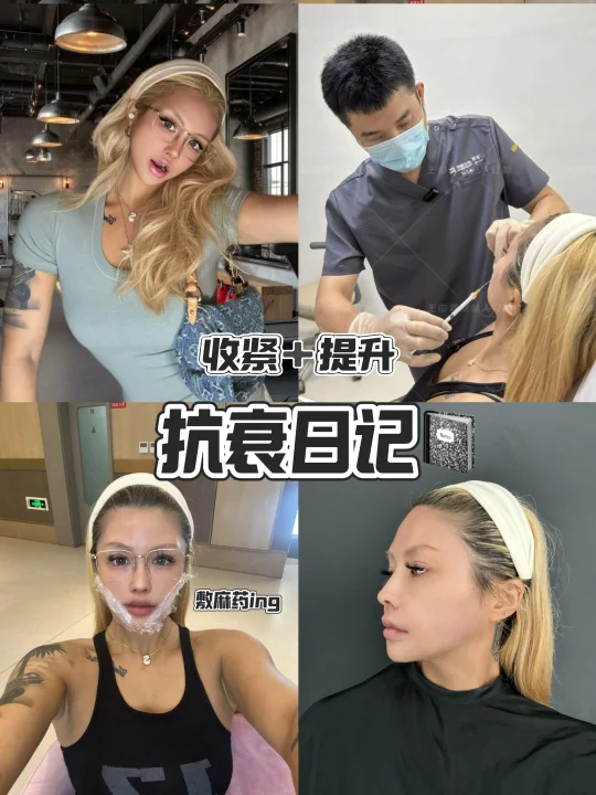 提高面部平整度｜倾研少女针让我年轻五岁🤍