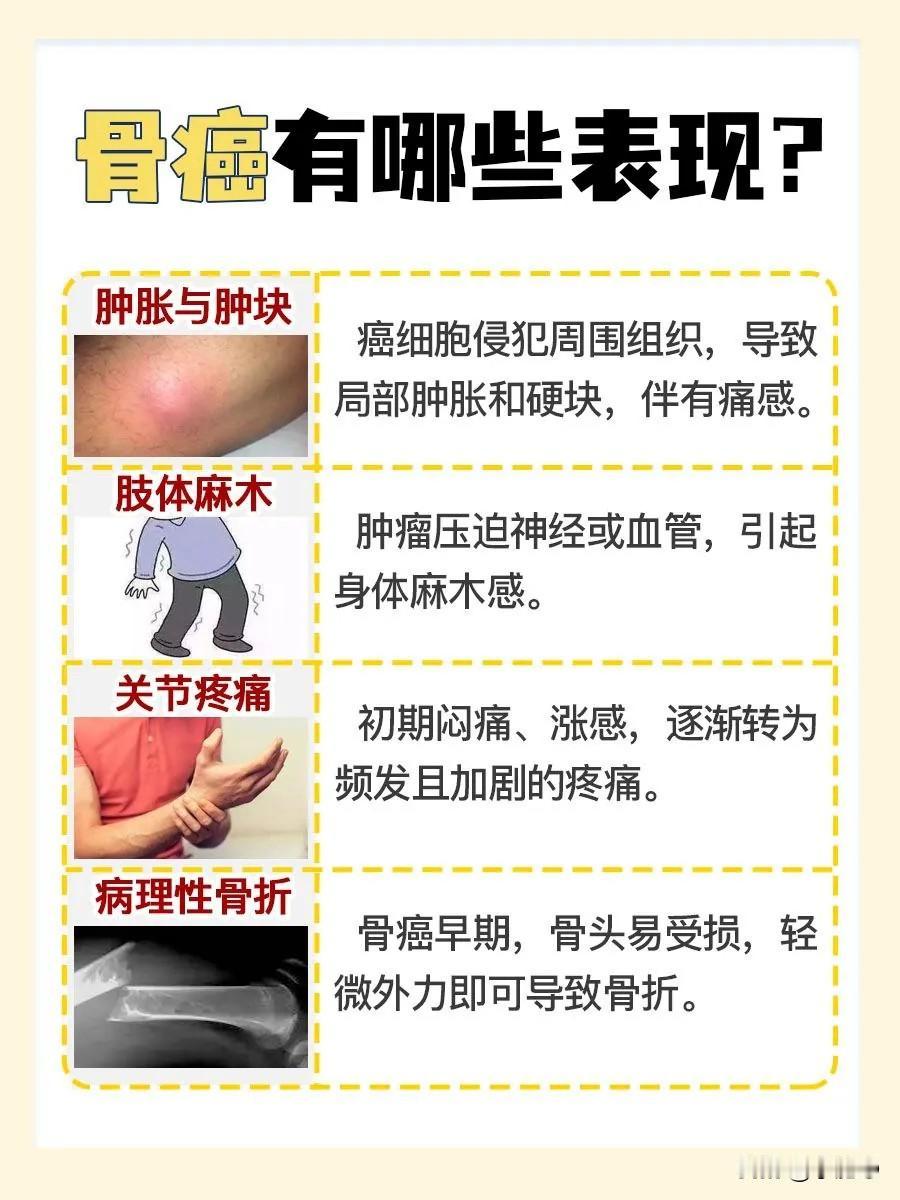 13岁女孩频繁屁股疼却被耽误治疗，最终确诊骨癌的新闻让人揪心不已。这个本该无忧无