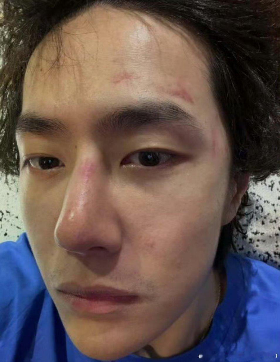 素颜，怼脸，晒伤照，就这么大咧咧的晒给全网看！而且大伙还都说帅！那这人是真的天然