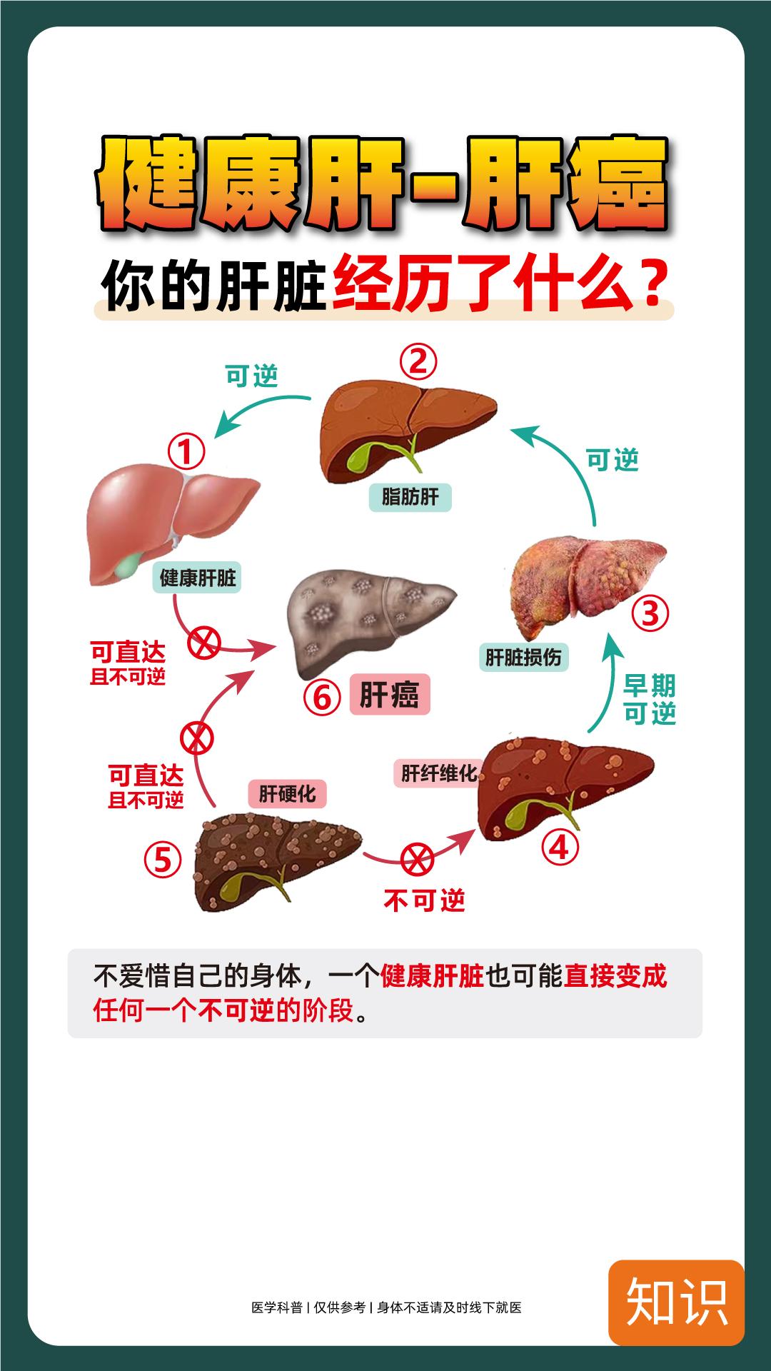 看看你的肝脏会变成什么样？好好护肝吧！