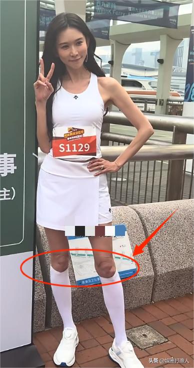 林志玲在昨天的马拉松上露面后，很多人都说她的脸保持的很好，但她腿上的褶子还是暴露