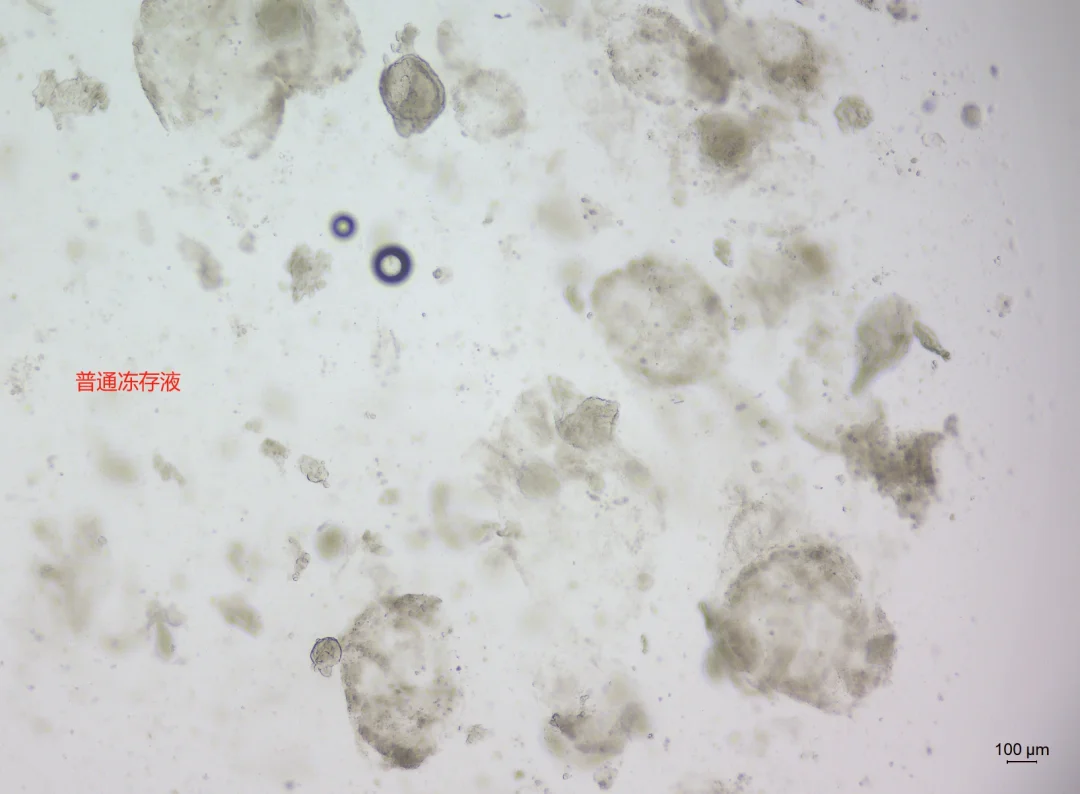 类器官冻存复苏不起来，冻存液选择很重要！