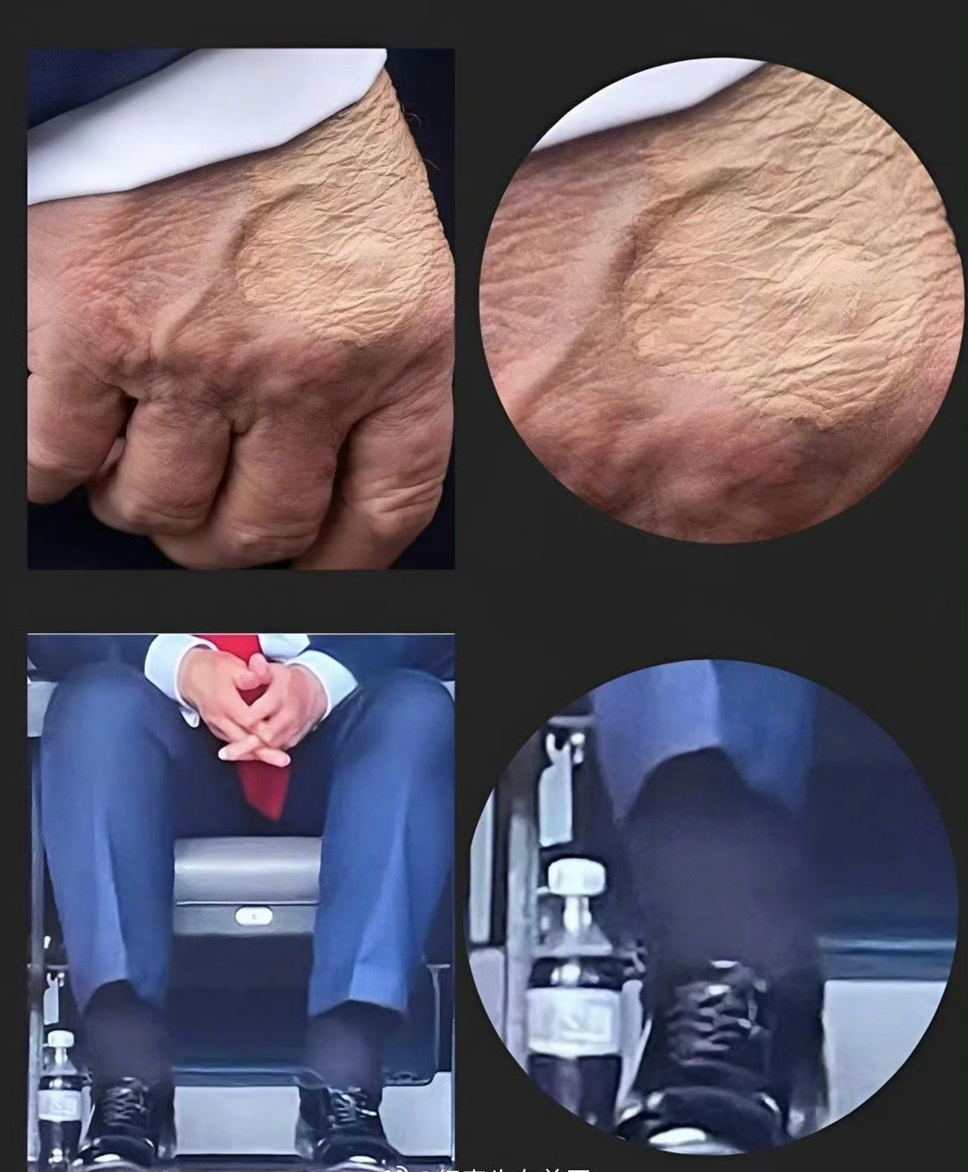 特朗普被确诊静脉疾病！特朗普被确诊患静脉疾病美众议院通过加密货币法案 ​​​