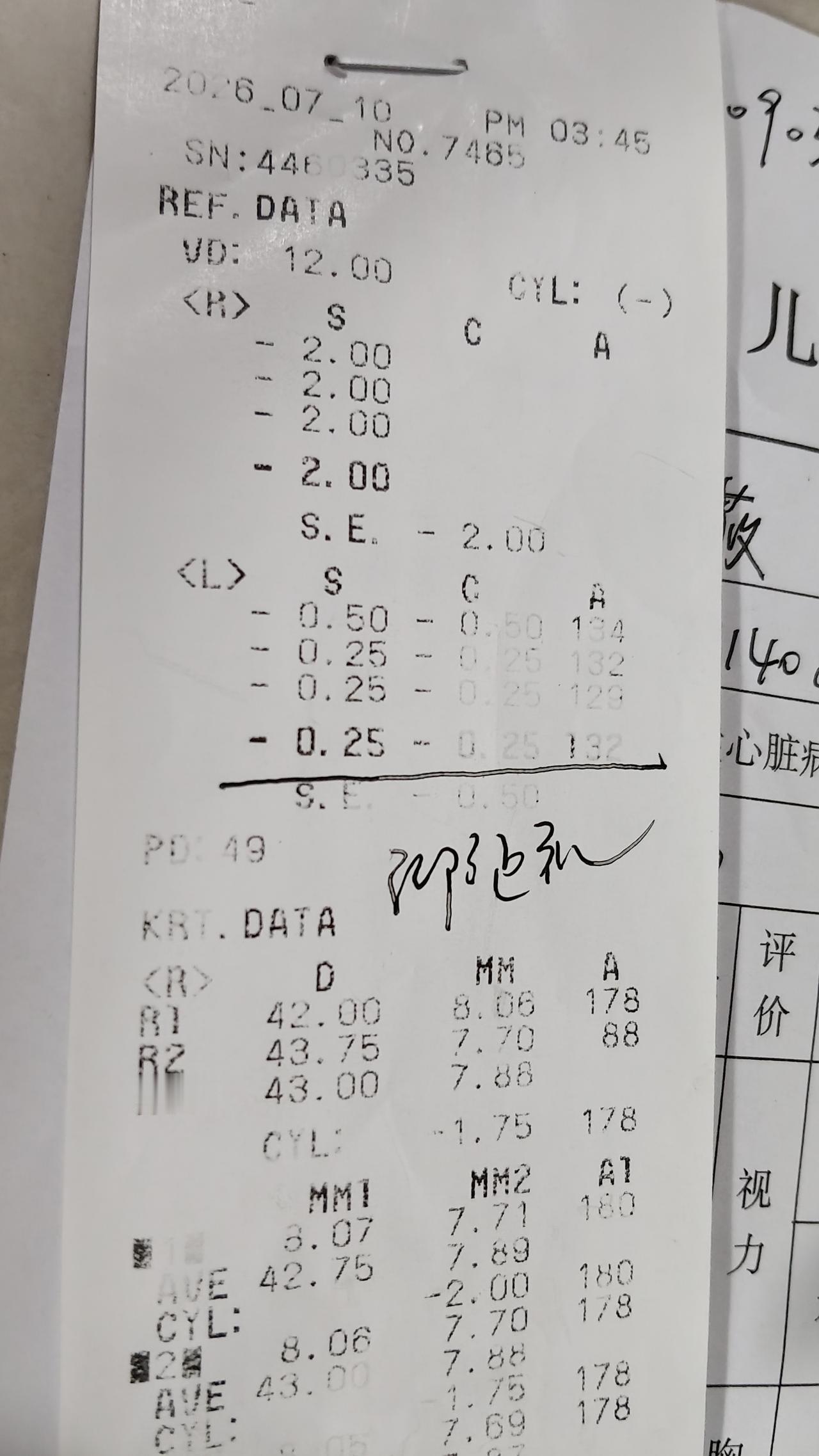 这是两个4岁7个月小朋友的视力体检报告
一个近视200度，一个近视500度，这样