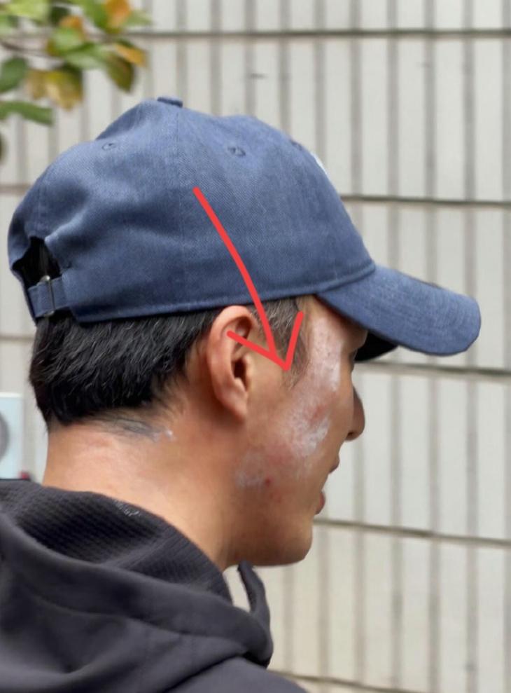 叶祖新也太拼了，

古装头套撕伤脸

其实这罪真没必要遭

好好一个帅小伙，整张