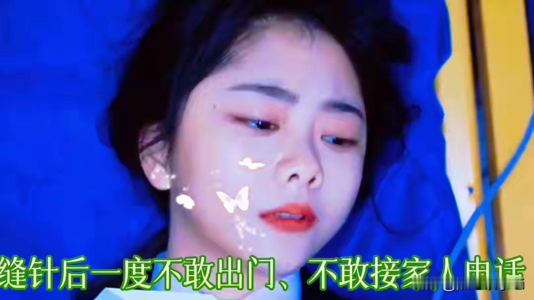 谭松韵回应2026年嘴部受伤细节，没有痛感，就留那么一点点，如果它全掉了，那就是