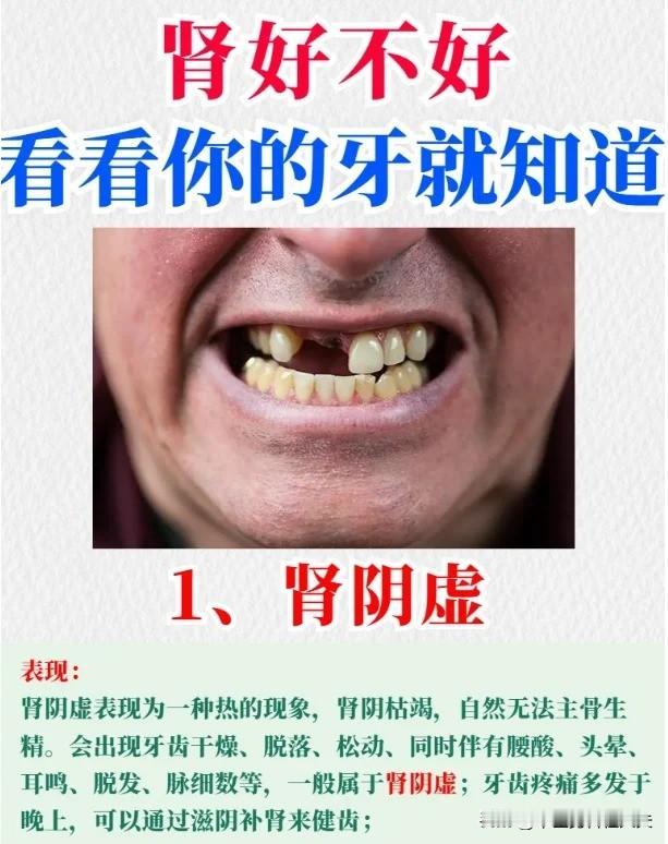 【中医智慧：肾主骨，牙齿竟是肾脏的 “健康晴雨表”！肾虚的 4 大表现你了解吗？