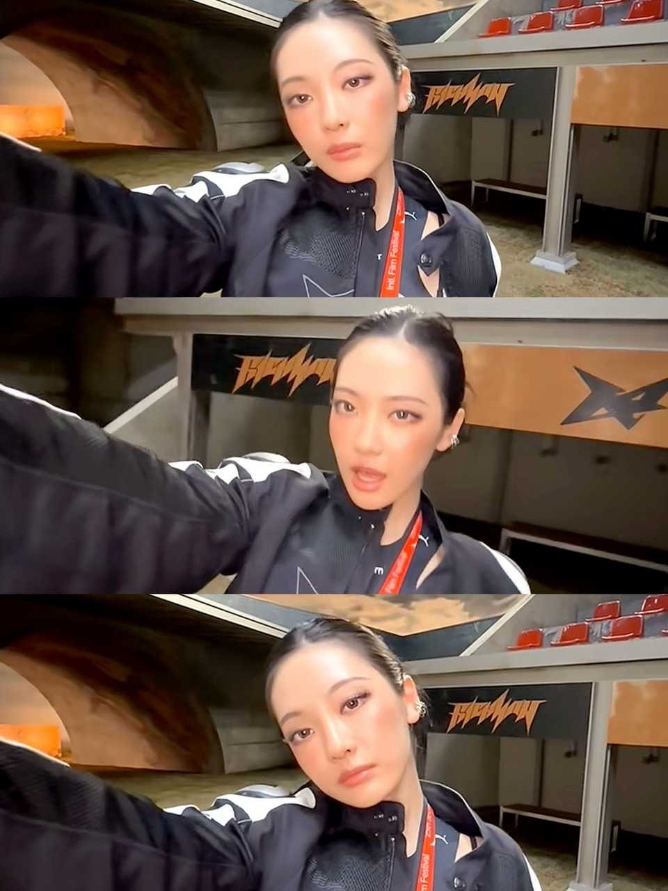 真搞了贴头皮 高颅顶哪儿去了 ​​​