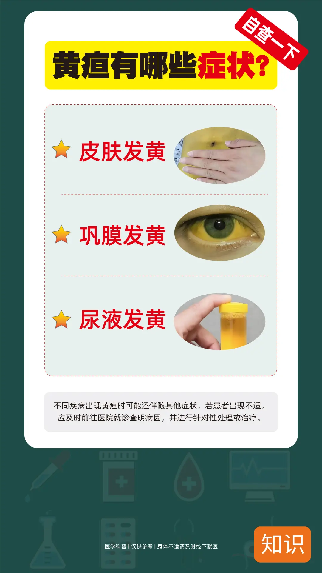 黄疸不仅要看皮肤还要看眼睛， 尿液