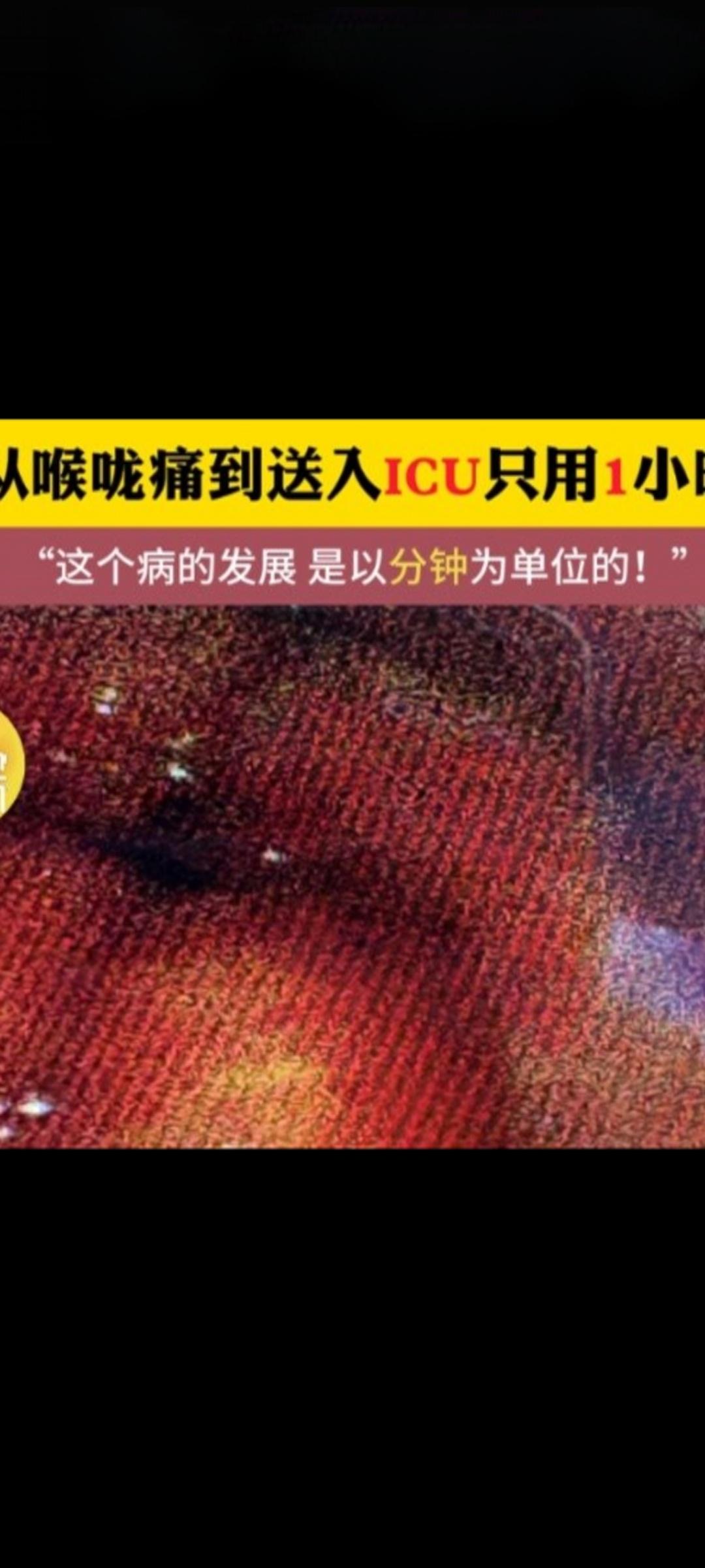 【喉咙痛1小时进ICU！这种"致命咽痛"千万别当上火】
 
45岁男子突发喉咙痛