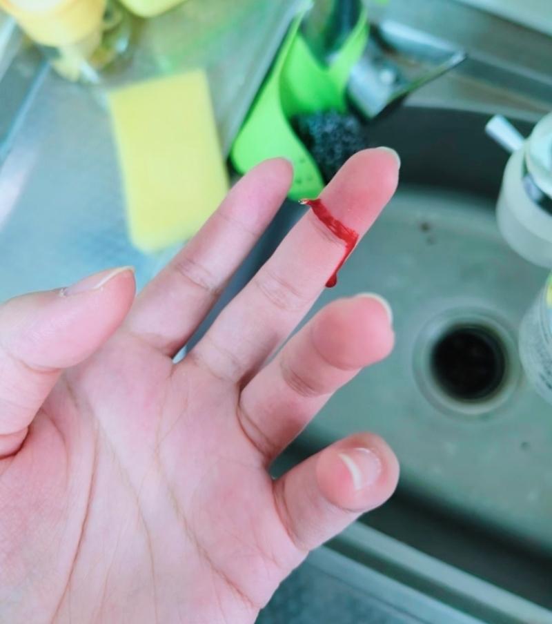 杯子落地时瞬间 
玻璃花绽放
轻轻的拾起 回馈指间一点红
·
好些事只可思   