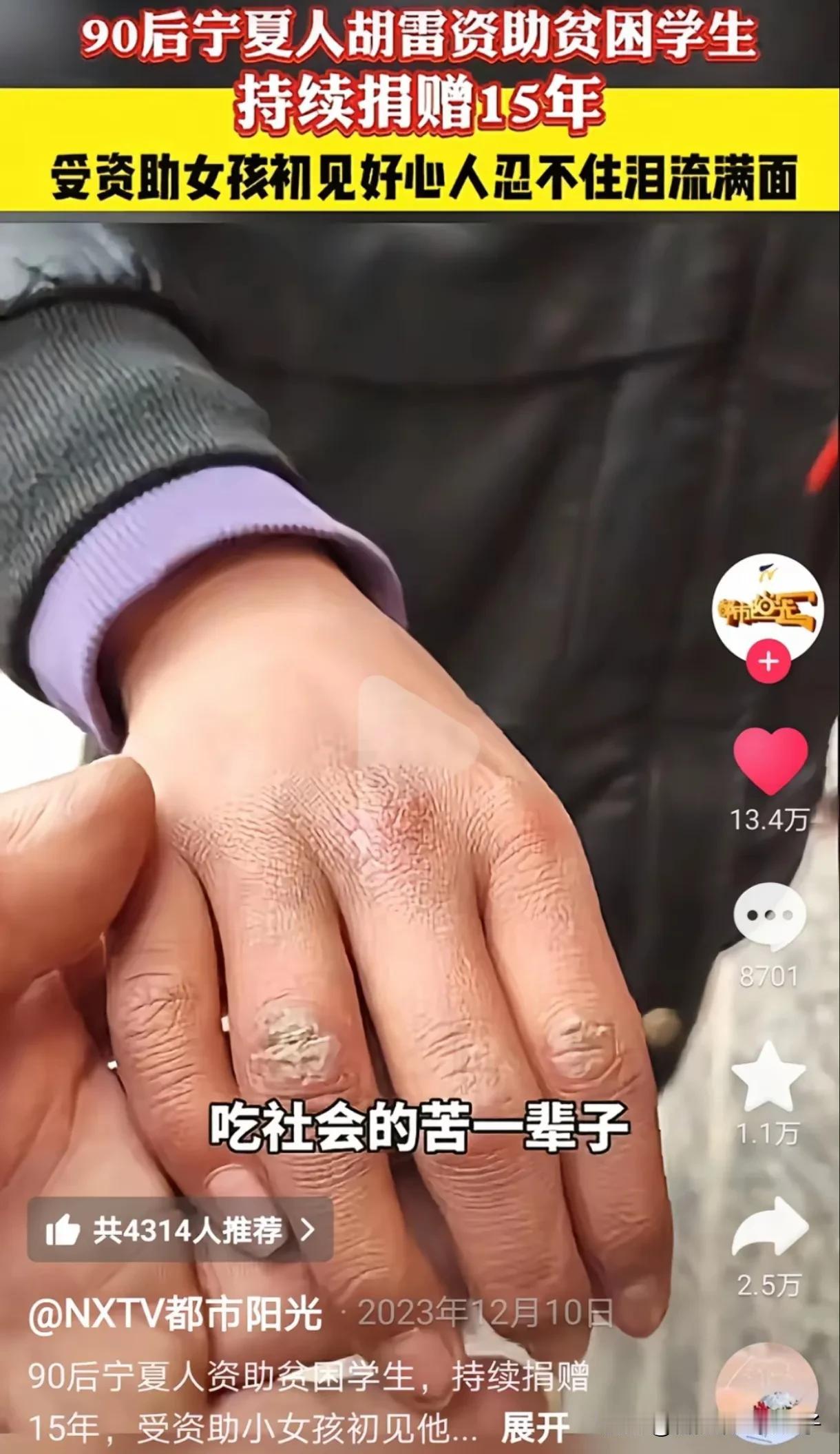 看到胡雷哭了，我没哭！
但看到小女孩满是伤痕的手，我哭了！

真的无法想象，小小