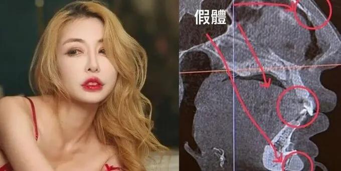 【惊！19次整形模特机场“闹钟”事件】你的脸上有螺丝吗？

听说过安检时因为金属