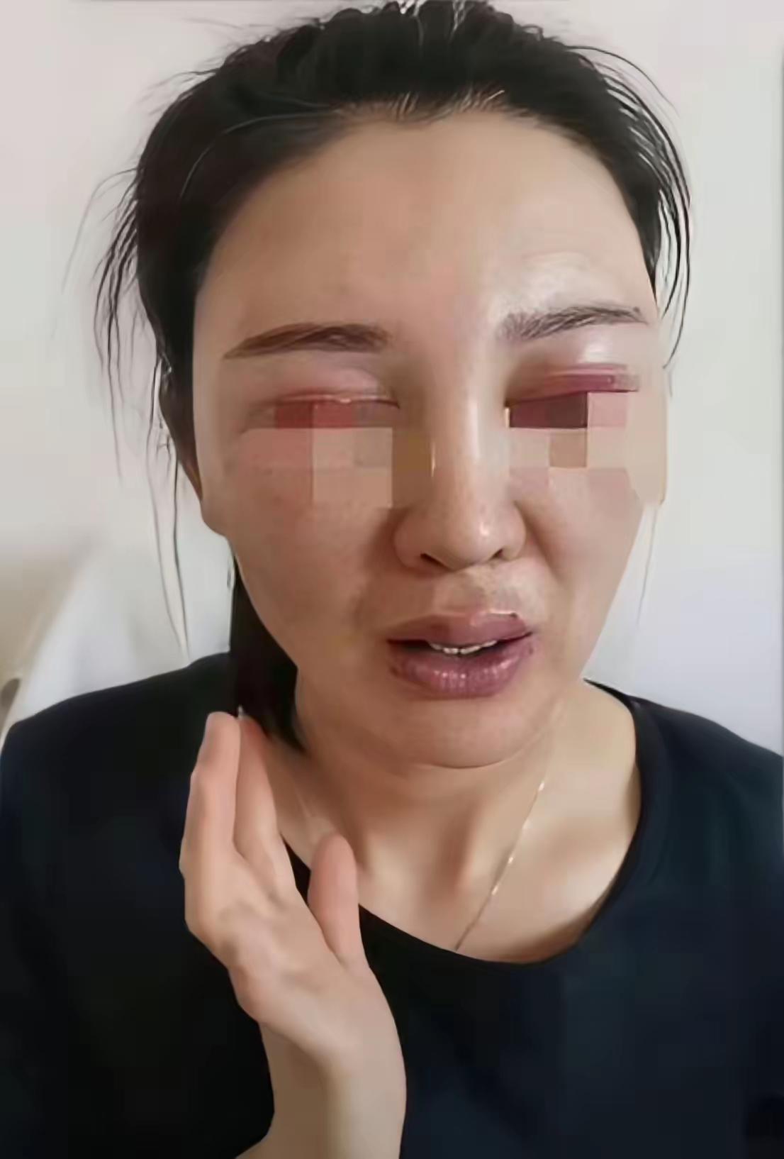 活该！这个被揍的鼻青脸肿的，漂亮的中国女孩大三的时候让时了印度阿三，恋爱期间对她