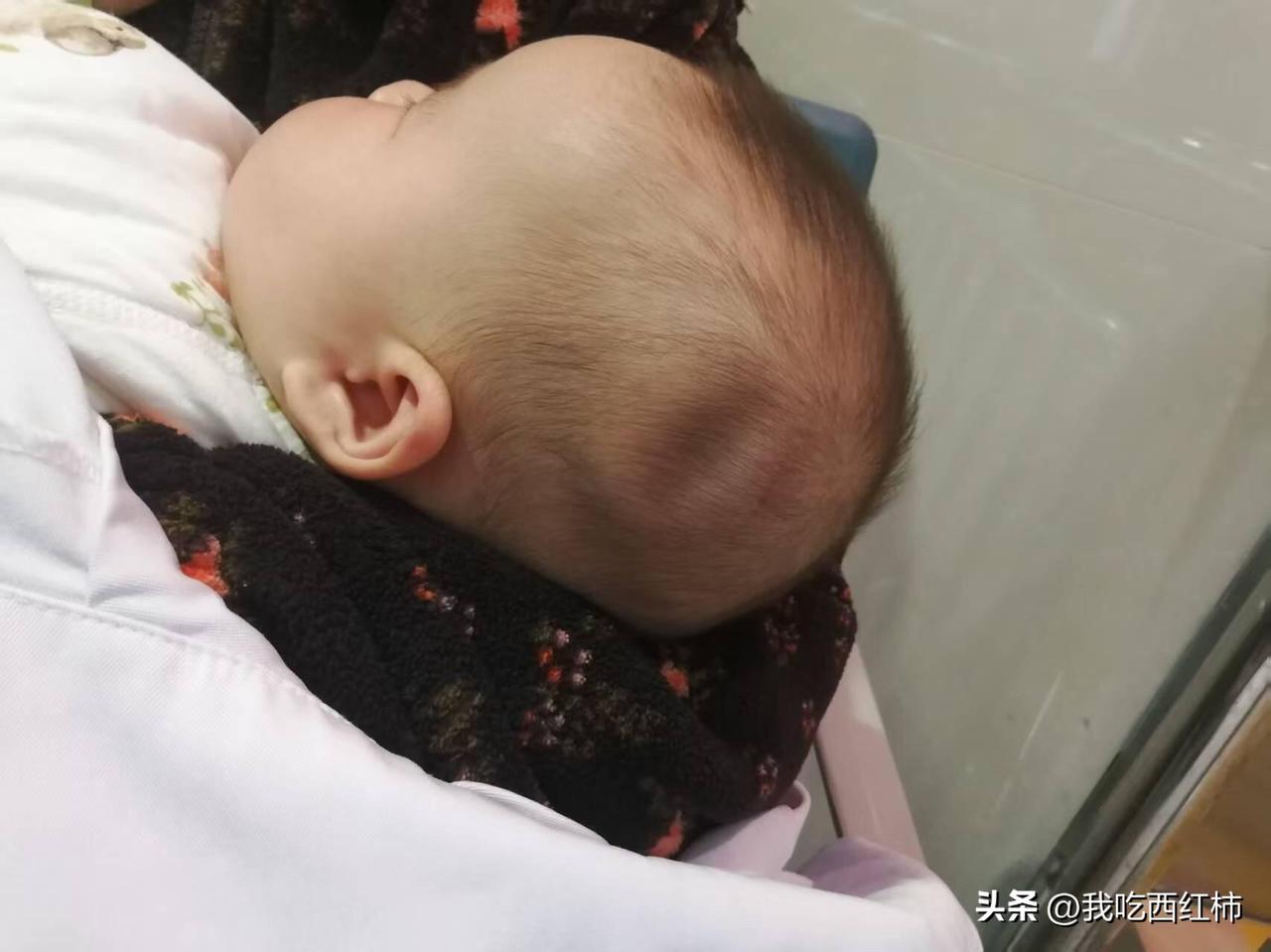 太可怜了！
宝宝从床上摔下来，做了CT目前没什么问题，让明天四维做个更深层的检查