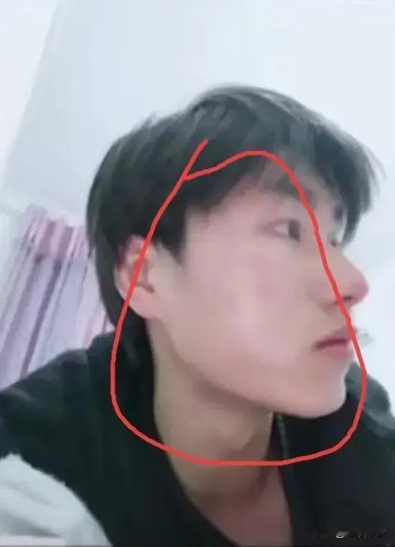 通过照片可以看出来，孩子的脸有浮肿的现象，表情看起来很懦弱，好像抑郁了似的，被渣