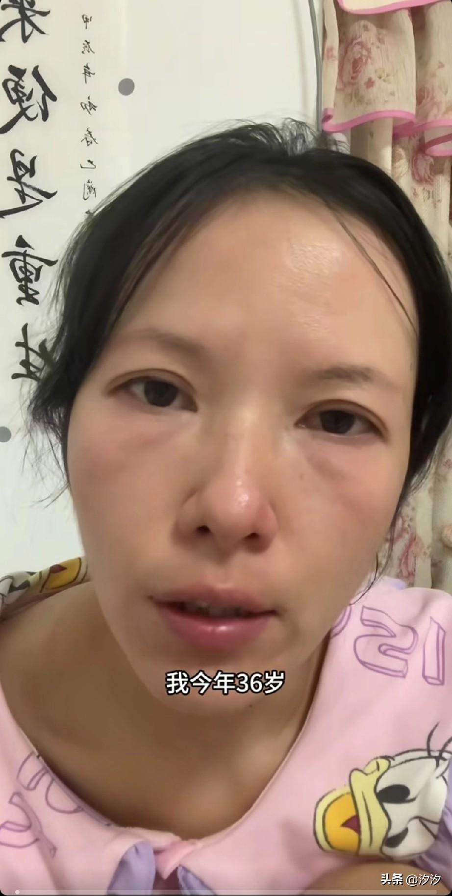 36岁的大龄剩女，
诉说了自己的不甘心，
她现在都有眼角纹了，
而且也出现了双下
