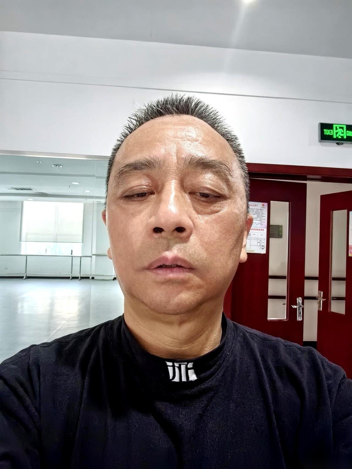 一张体检报告，直接给我判了三个“死缓”。
高血压，糖尿病，外加一个脖子里正在长大