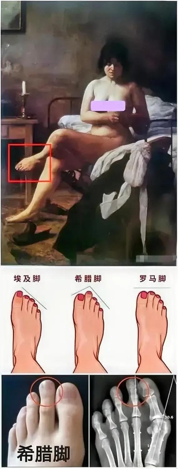 希腊脚！[发怒]
这种脚，漂亮但不实用！

这幅画，是19世纪，一位阿根廷画家的