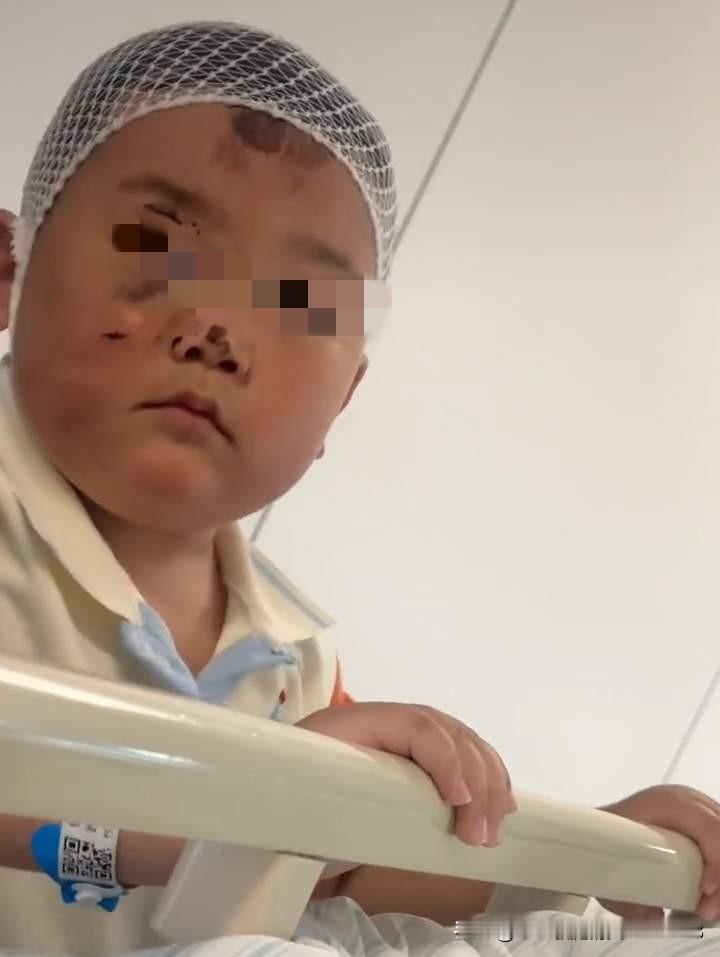近日，浙江一位单亲妈妈带着3岁多的儿子送外卖途中遭遇车祸，妈妈浑身多处骨折，3岁