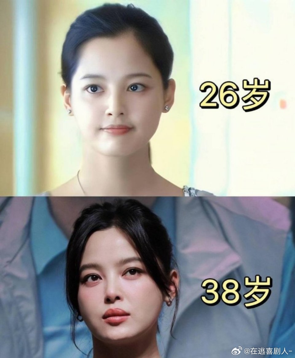 辛芷蕾早期嘴唇也不这样啊 ​​​