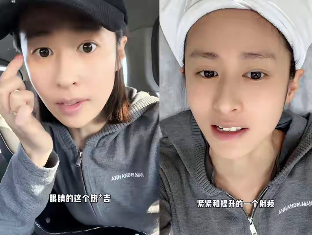 37岁颖儿晒去医美疼到哭，上万元一次一月两次，花钱遭罪美是真美 