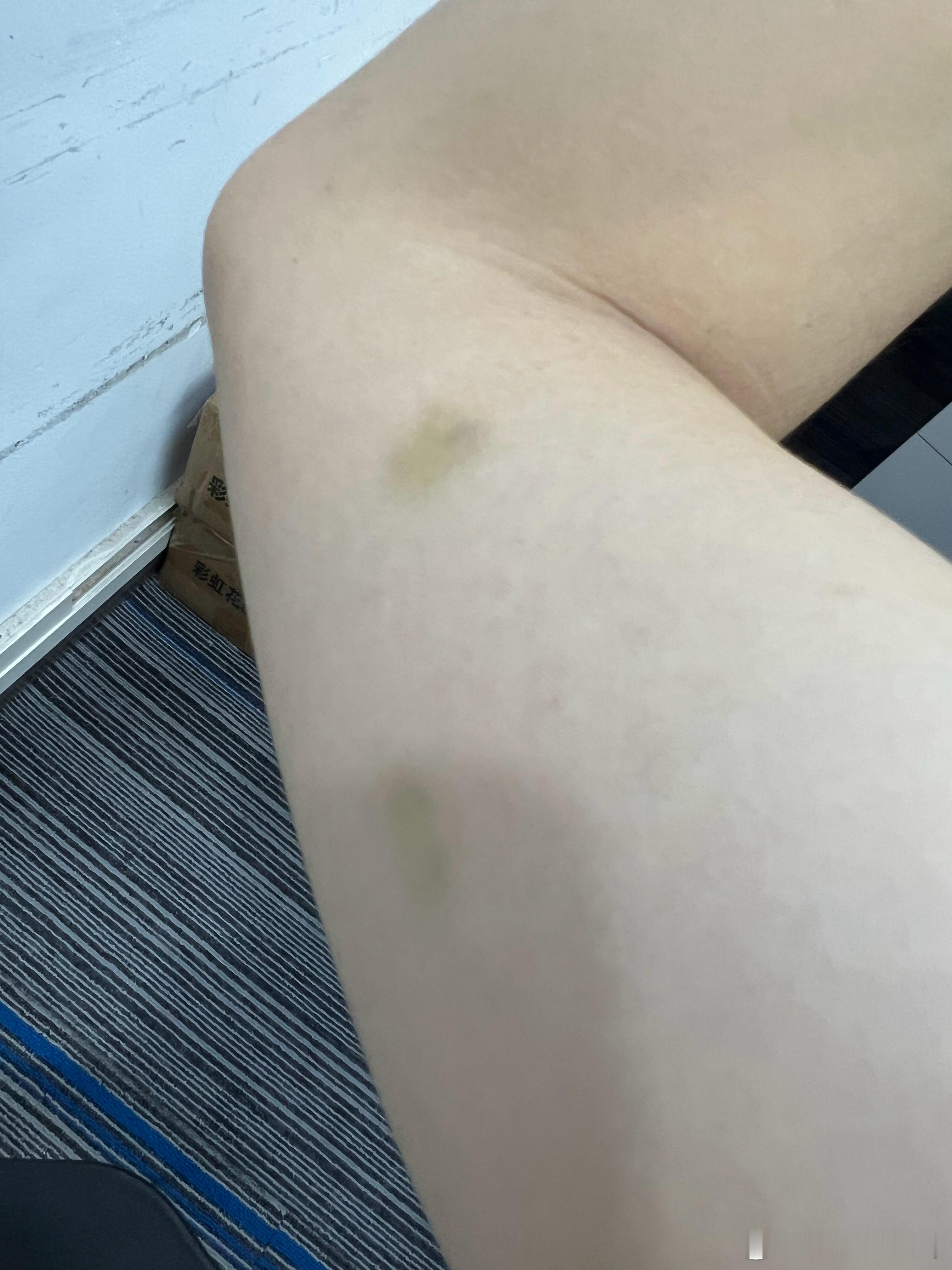 这是为啥啊，也没撞过啥的 广州·珠江新城