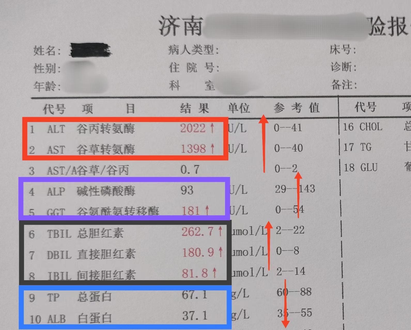 这4类乙肝人群是肝硬化的易发人群，一定要警惕！ 1.乙肝病毒迟迟未转阴...