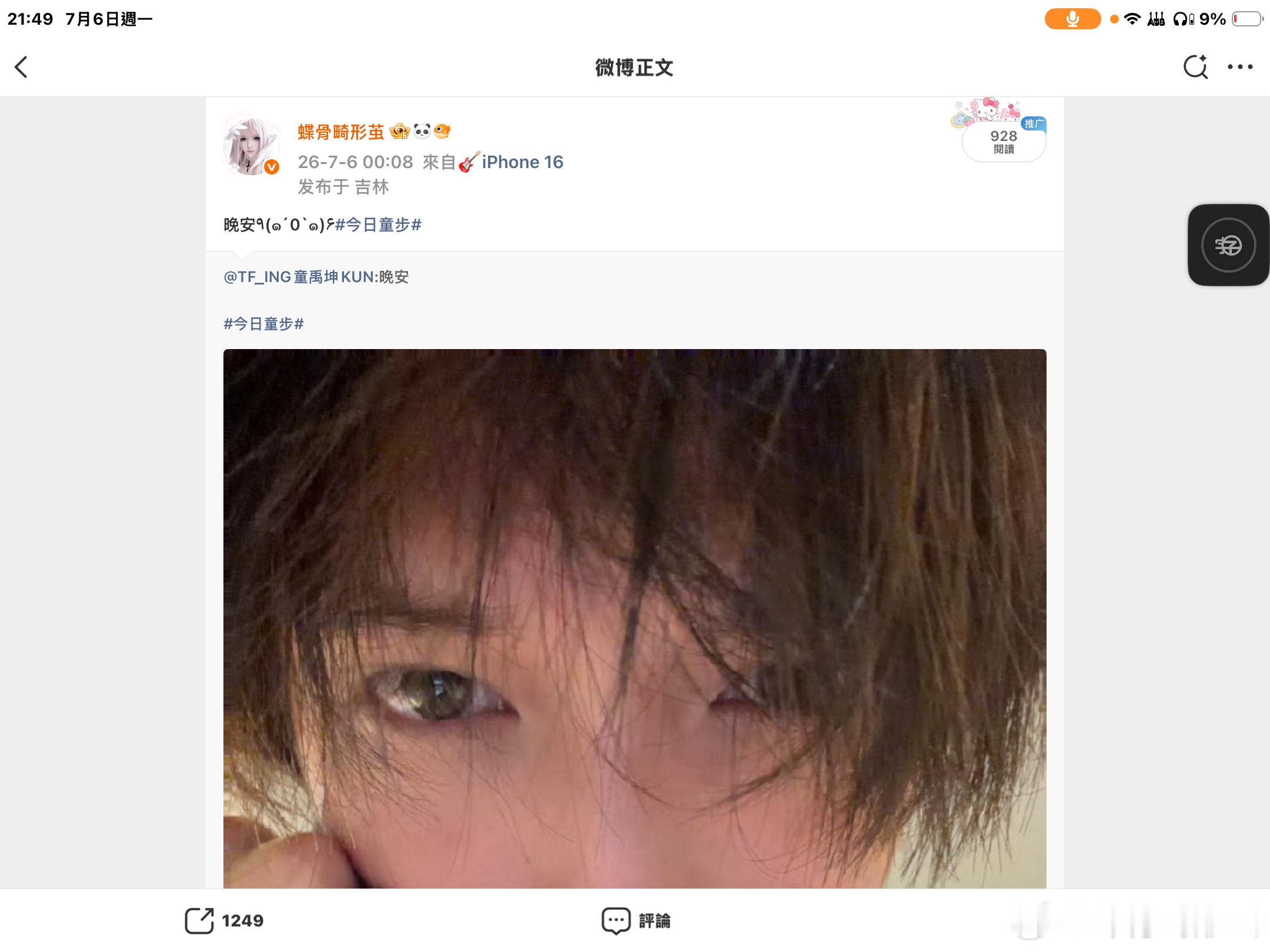 童禹坤  🤎童禹坤 盈月歌喉 和声共振 二十轮迹0706-蝶骨畸形茧🧱：12