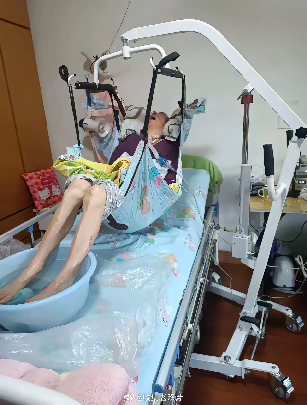 这是在“渡劫”吧？走不了，活不好。如果老人不想吃东西，就不要鼻饲了，顺其自然才是