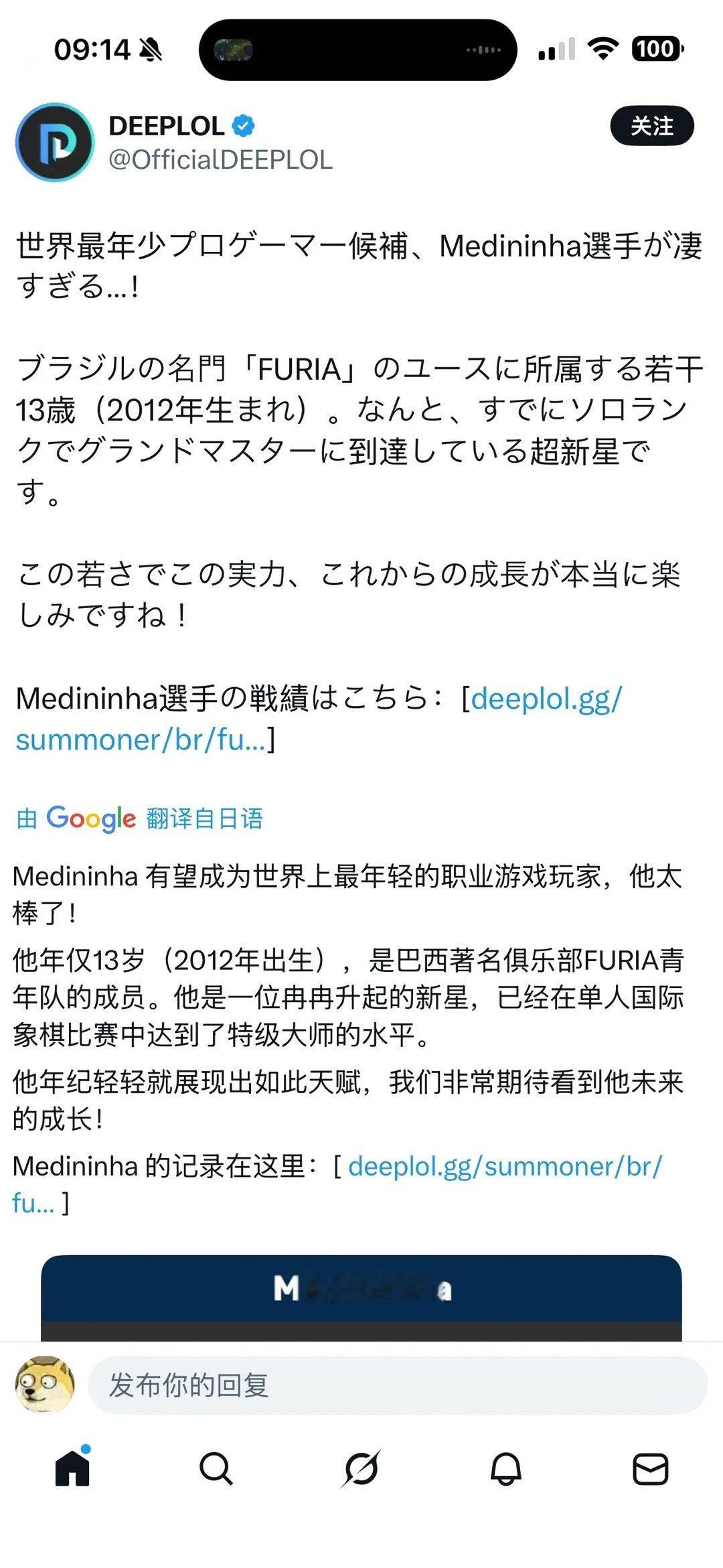 最近巴西赛区的黑豹签下了一位13岁的小朋友. 虽然年龄比游戏还小 但是已经是大师