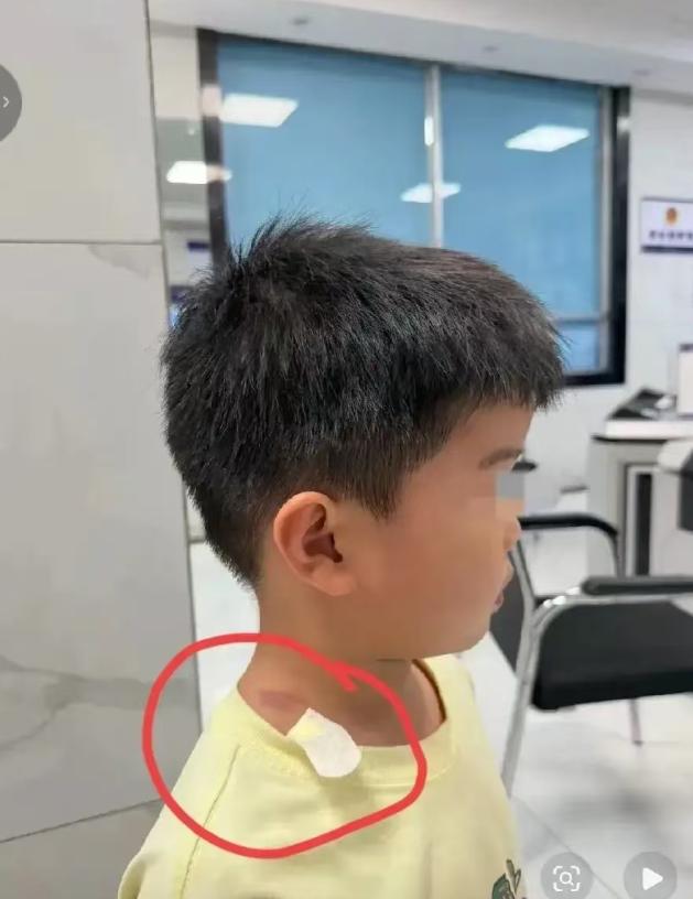 长沙 “摸臀事件” 已经传到国外去了！我一个在国外生活多年的朋友说的很直白：“这