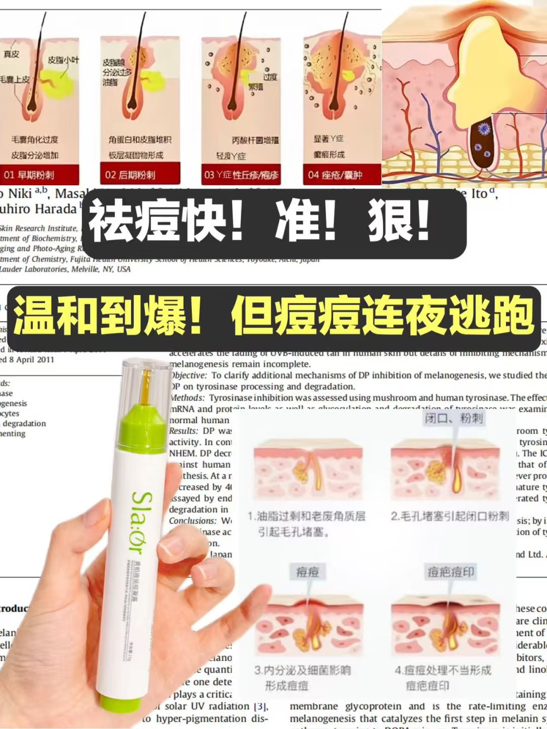 战痘多年没效果？这款宝藏值得一试