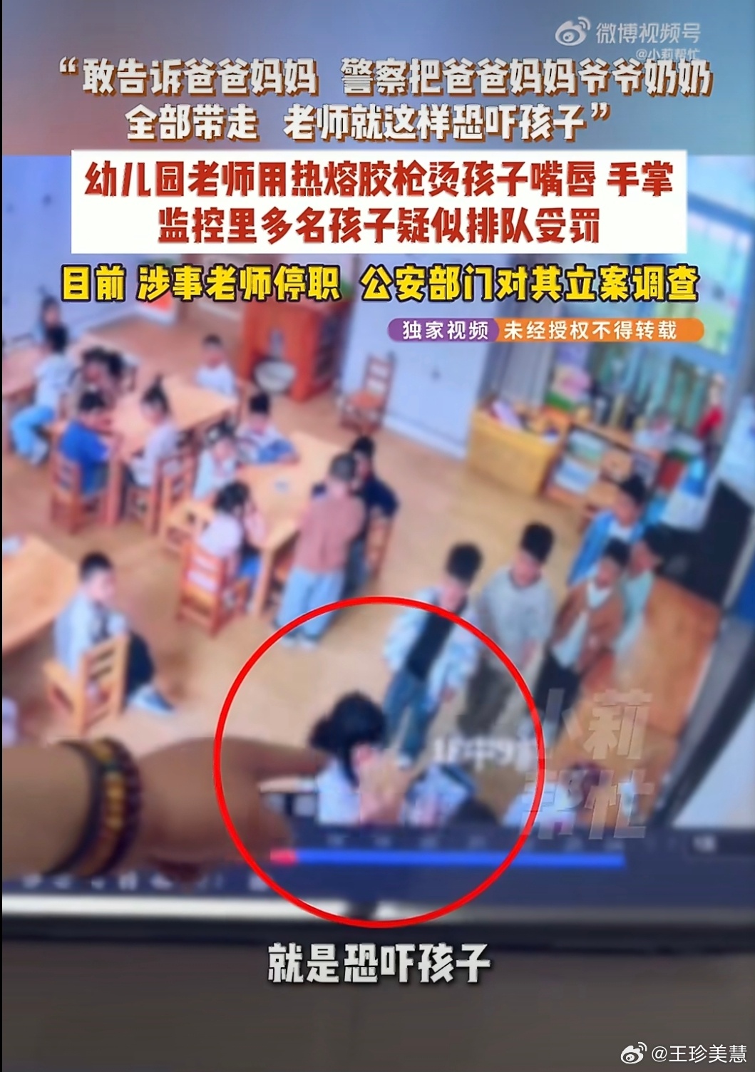 多名幼儿园小朋友被老师用热熔胶烫伤这种人是怎么当上老师的，一定得把她们抓进去吃牢