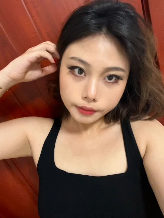 花2w玻尿酸太阳穴，算回报率高吗（🆚对比）