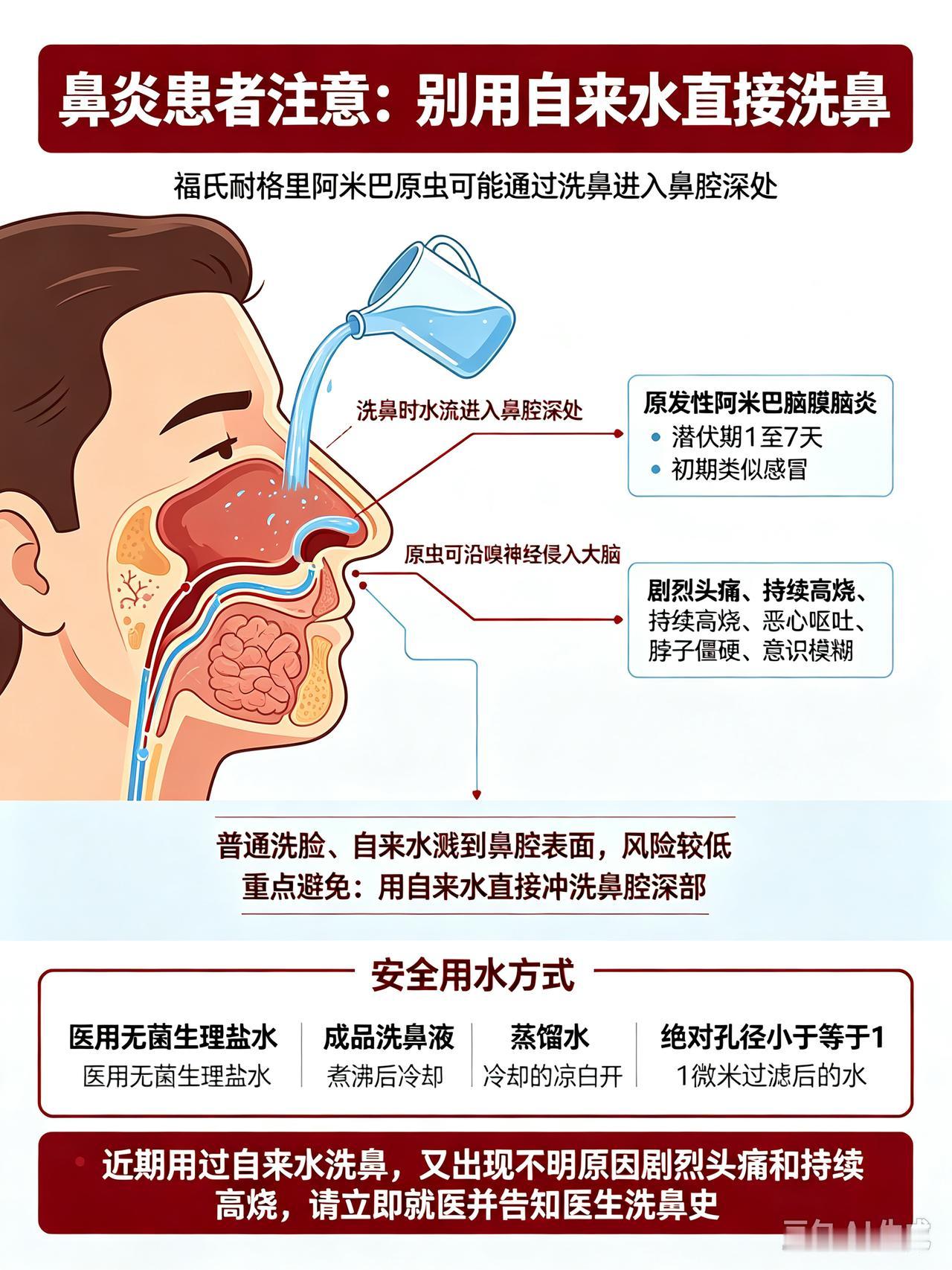 有鼻炎的伙伴要注意了！千万别再用这种方式缓解症状。
 
本人有多年鼻炎史，一到换