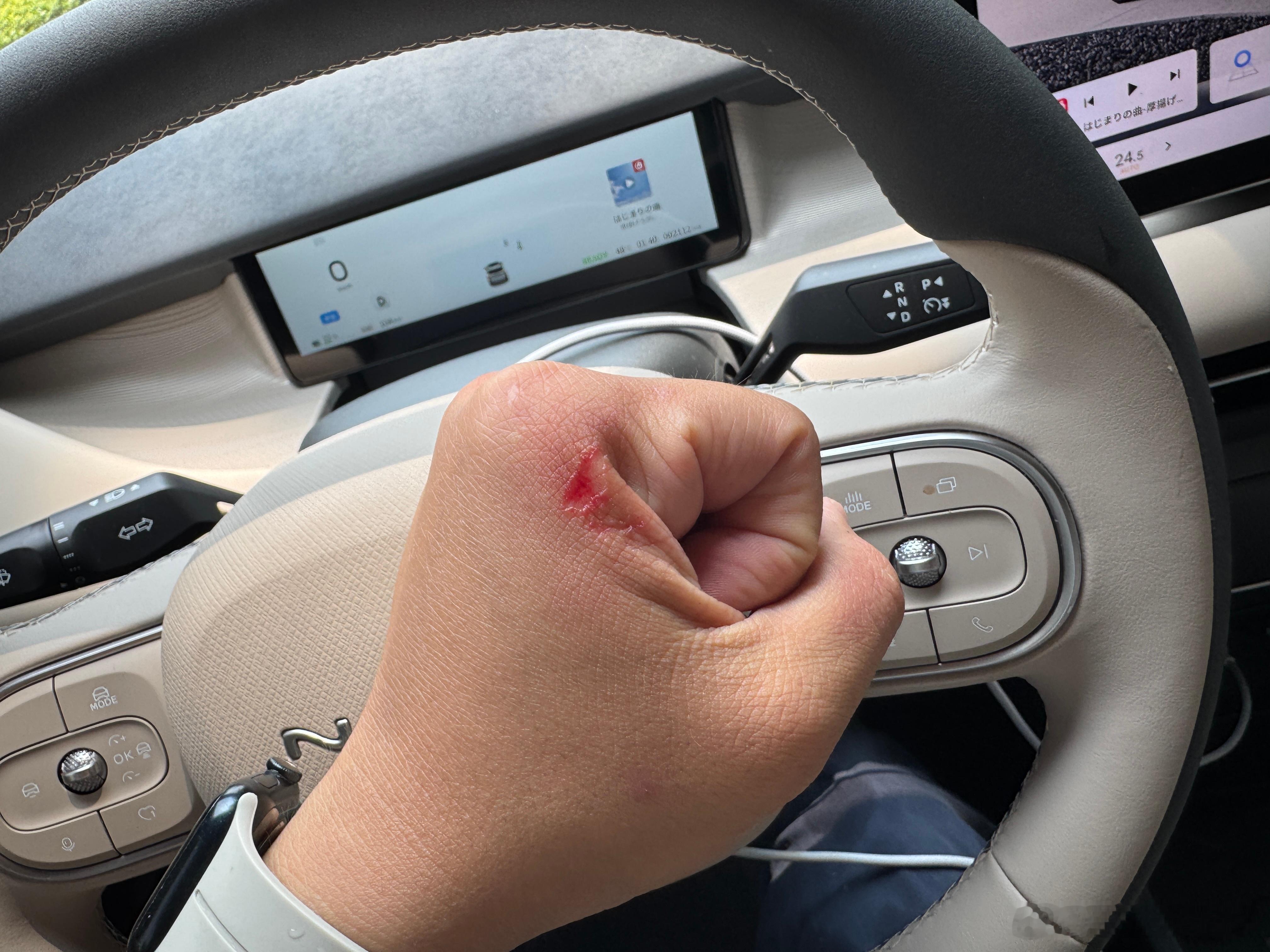 拿高压水枪洗车刷鞋，不小心冲到手了，痛😓 ​​​