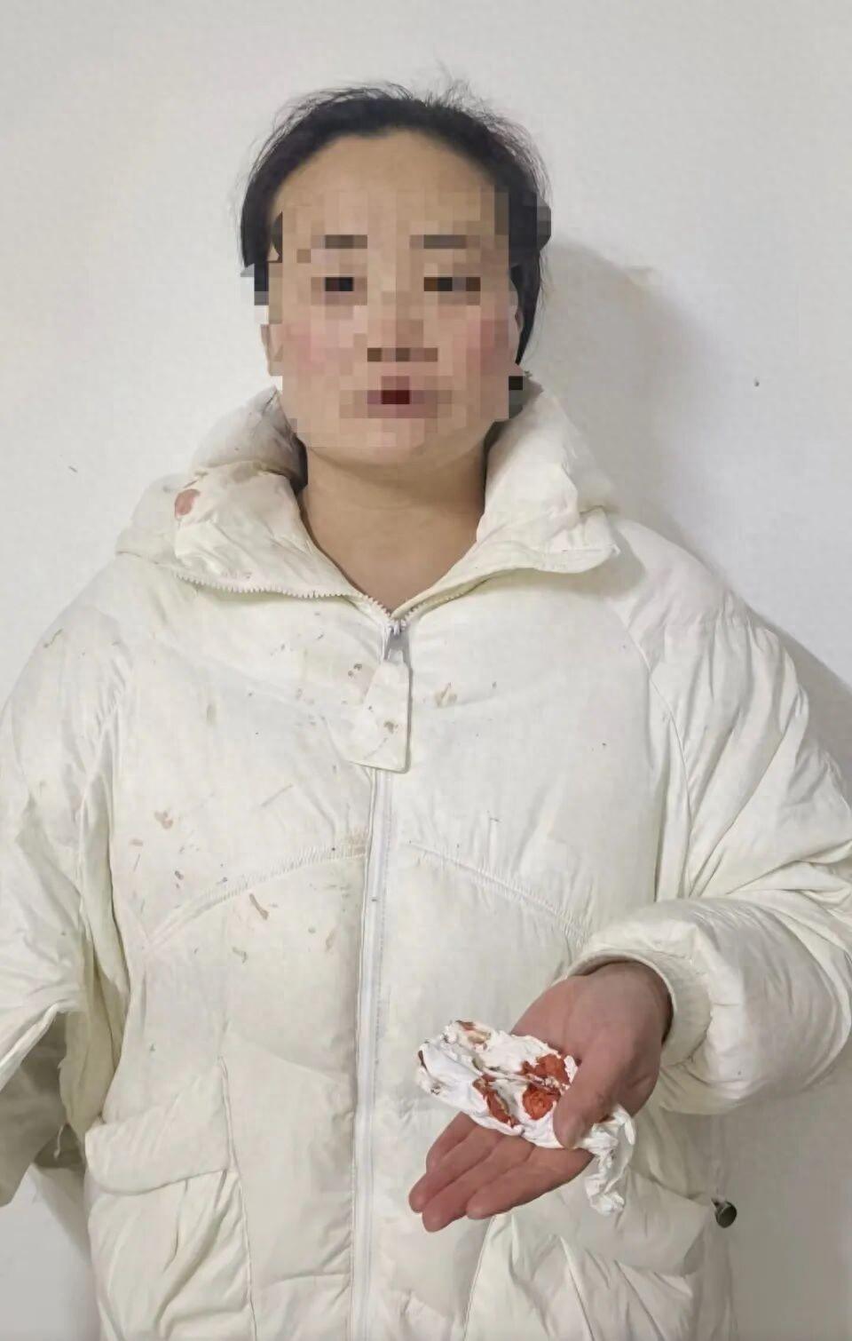 “太心酸了！”湖北恩施，女子结婚14年被家暴13年，从新婚没多久开始，丈夫的家暴
