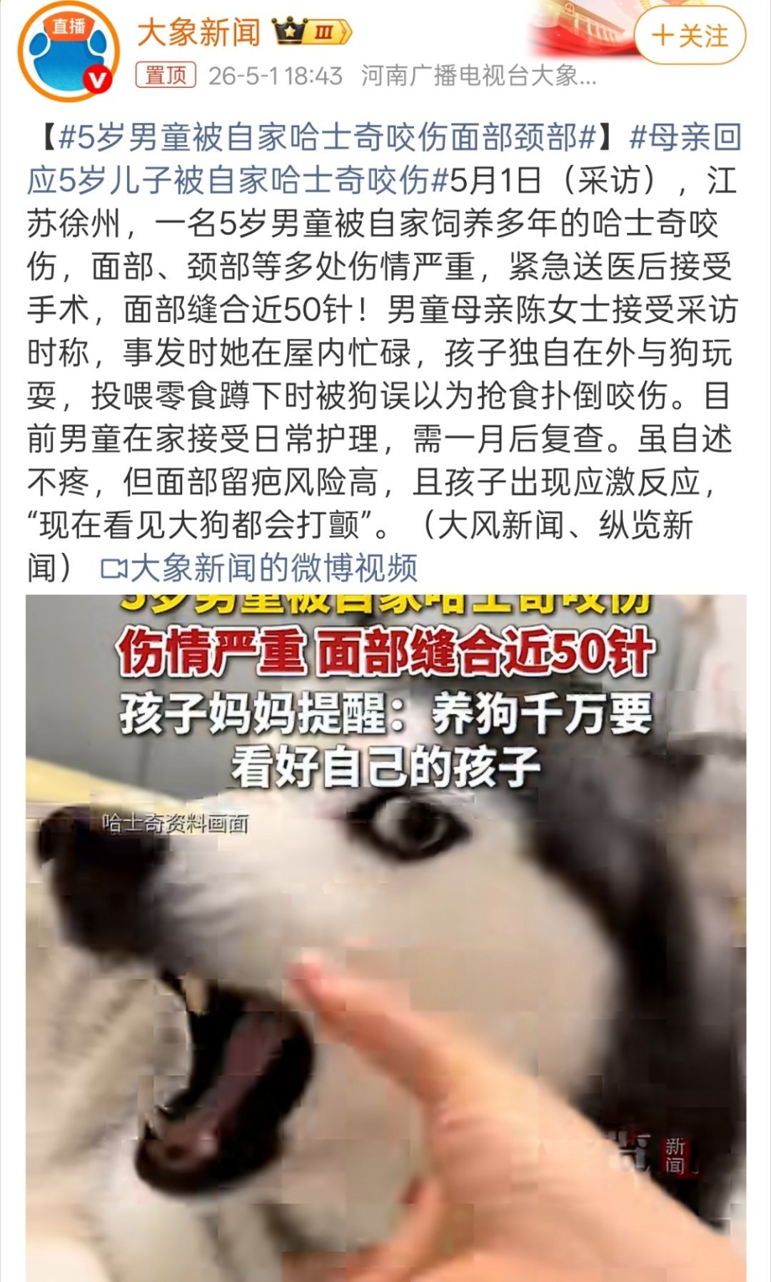 5岁男童被自家哈士奇咬伤面部颈部“投喂零食蹲下时被狗误以为抢食扑倒咬伤。”这种护