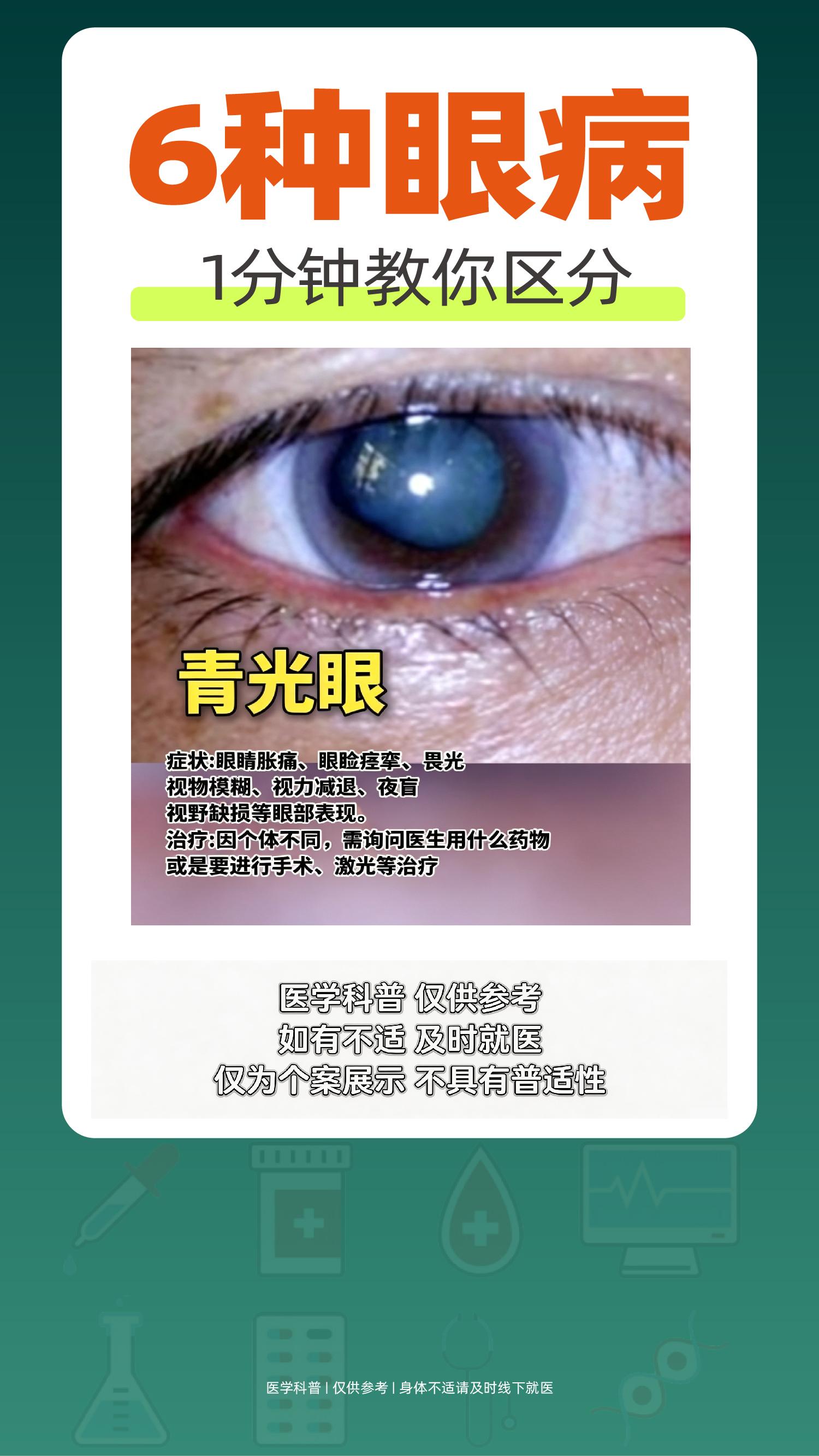 6种眼病，1分钟教你区分。