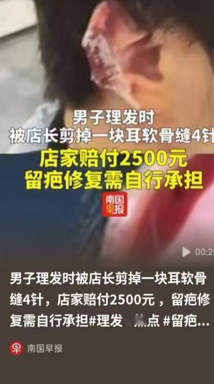 湖北，一个男子去剪头发，店长一个不小心，把他的一块耳软骨给剪了，他们拿创口贴止血