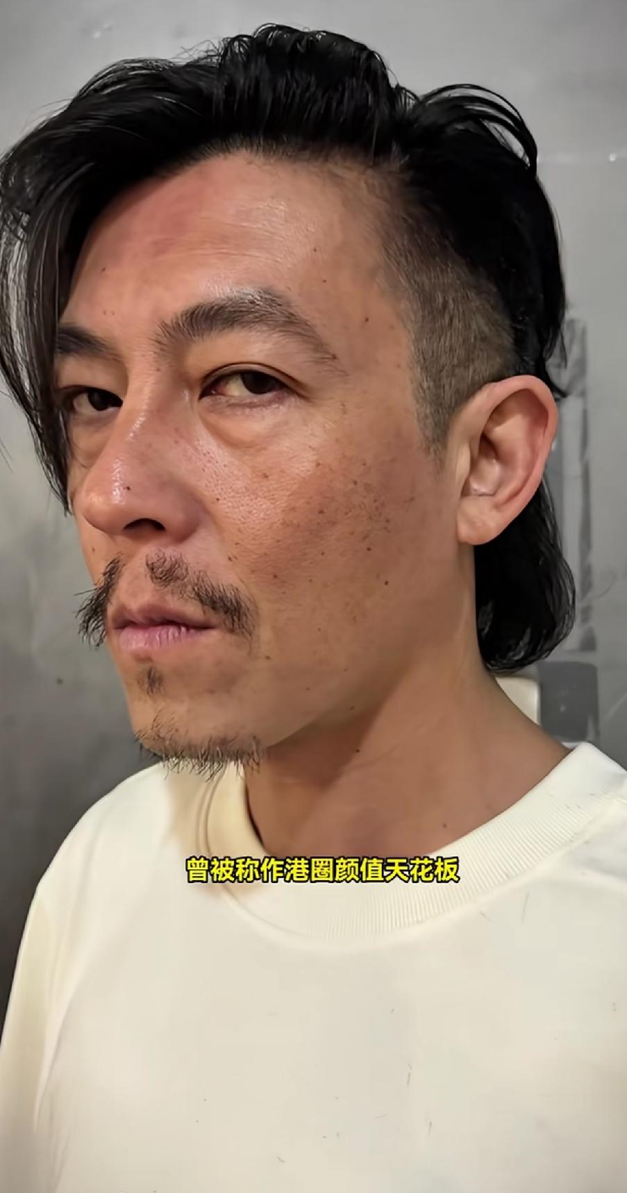 陈冠希也不打扮收拾一下自己，满脸雀斑，胡子拉碴的，曾经港圈的颜值天花板，如今已变
